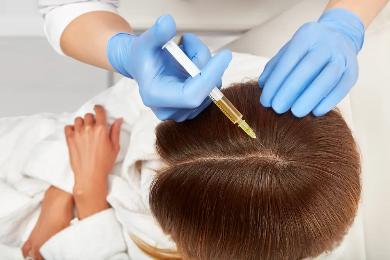 علاج PRP