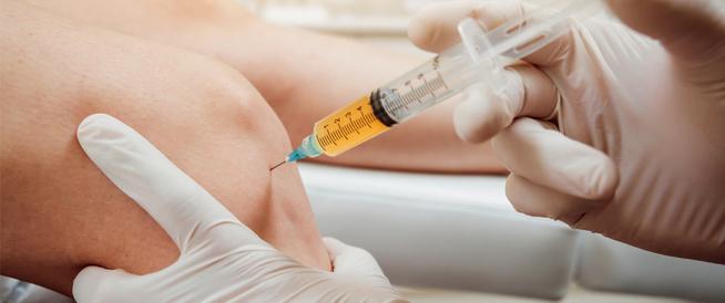 نتائج علاج PRP